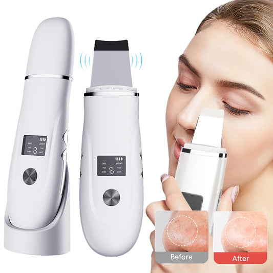 3-in-1 Ultrasonic Face Scrubber – Deep Pore Cleanser with EMS Lifting & Ion Technology