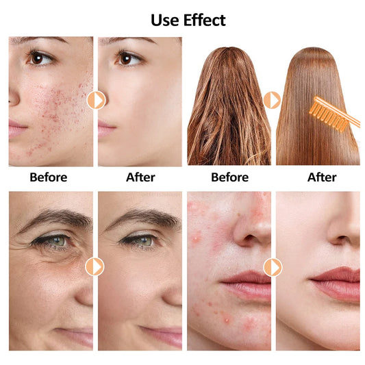 Clear Glow High Frequency Wand